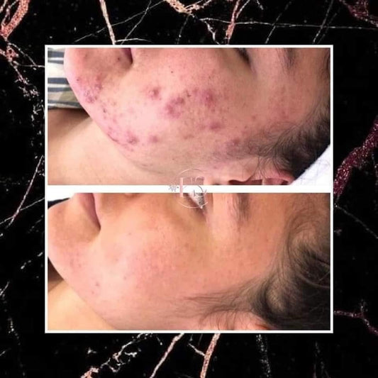 Cremă reparatoare cu extract de melc