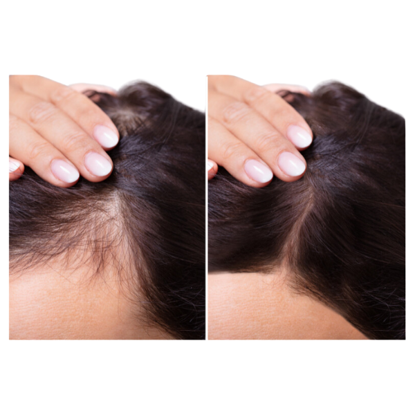 Spray de Retuș pentru Păr – Castaniu Închis acoperire fire albe